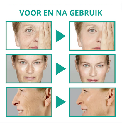 Sérum Mágico Botox para la Piel